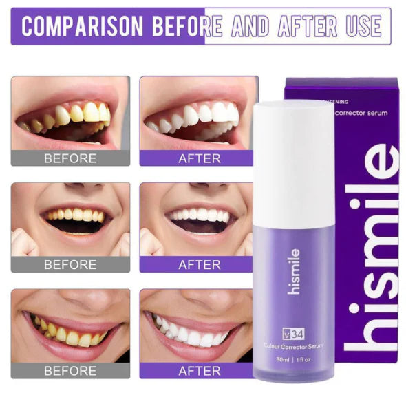 Hismile v34 Colour Corrector, Purple Teeth Whitening