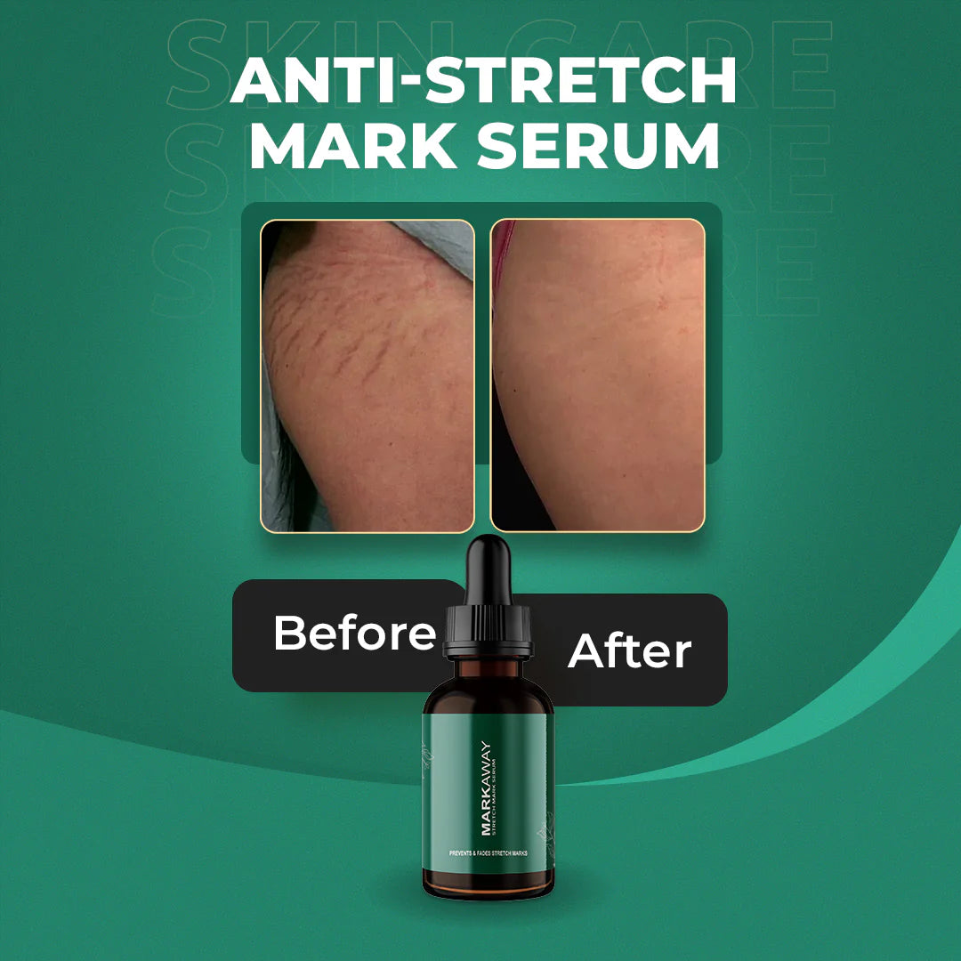Anti-Stretch Markaway Stretch Mark Serum